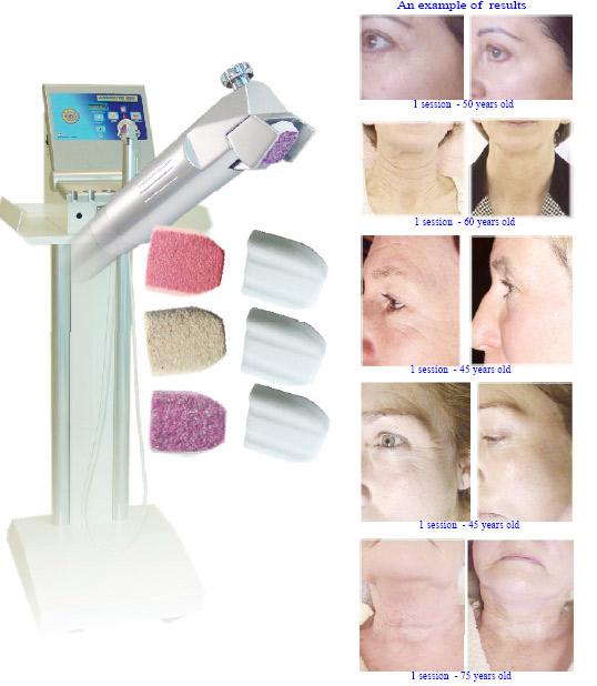 /_uploaded_files/abrastim2.jpg /_uploaded_files/abrastim2.jpg